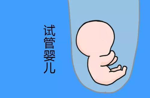 妇科微创